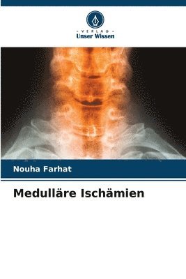 Medulläre Ischämien