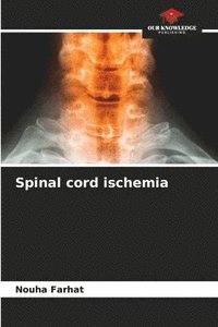 bokomslag Spinal cord ischemia