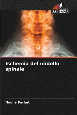 bokomslag Ischemia del midollo spinale