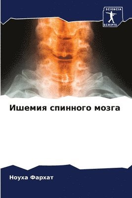 &#1048;&#1096;&#1077;&#1084;&#1080;&#1103; &#1089;&#1087;&#1080;&#1085;&#1085;&#1086;&#1075;&#1086; &#1084;&#1086;&#1079;&#1075;&#1072; 1