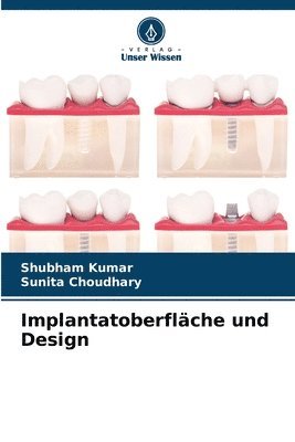 Implantatoberflche und Design 1