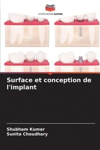 bokomslag Surface et conception de l'implant