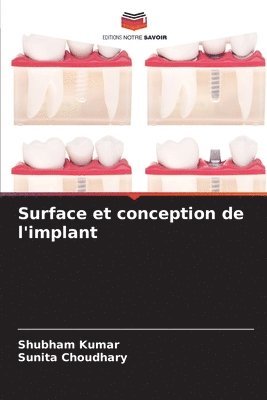 bokomslag Surface et conception de l'implant