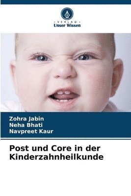 Zohra Jabin, Neha Bhati, Navpreet Kaur - Post und Core in der Kinderzahnheilkunde, Häftad