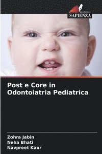 bokomslag Post e Core in Odontoiatria Pediatrica