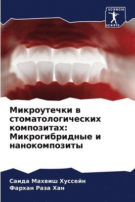 Микроутечки в стоматологических компози&