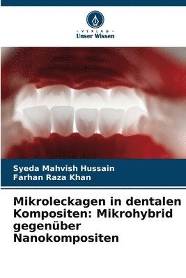 bokomslag Mikroleckagen in dentalen Kompositen