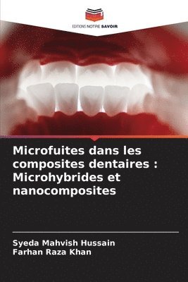 bokomslag Microfuites dans les composites dentaires