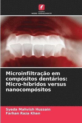 bokomslag Microinfiltrao em compsitos dentrios