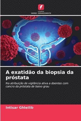 bokomslag A exatidão da biopsia da próstata