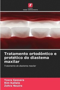 bokomslag Tratamento ortodntico e prottico do diastema maxilar