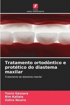 bokomslag Tratamento ortodntico e prottico do diastema maxilar