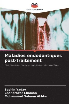 bokomslag Maladies endodontiques post-traitement