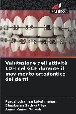 Valutazione dell'attivit LDH nel GCF durante il movimento ortodontico dei denti 1