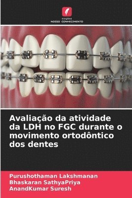 Purushothaman Lakshmanan, Bhaskaran Sathyapriya, Anandkumar Suresh, Bhaskaran SathyaPriya - Avaliação da atividade da LDH no FGC durante o movimento ortodôntico dos dentes, Häftad