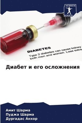 Амит Шарма, Пуджа Шарма, Дургадас Анхор, &#1 &#1064;&#1072;&#1088;&#1084;&#1072;, ¿¿¿¿ ¿¿¿¿¿, ¿¿¿¿¿ ¿¿¿¿¿, Amit Sharma - Диабет и его осложнения, Häftad