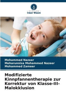 Mohammed Nazeer, Meharunnisa Mohammed Nazeer, Mohammed Zameer - Modifizierte Kinnpfannentherapie zur Korrektur von Klasse-III-Malokklusion, Häftad
