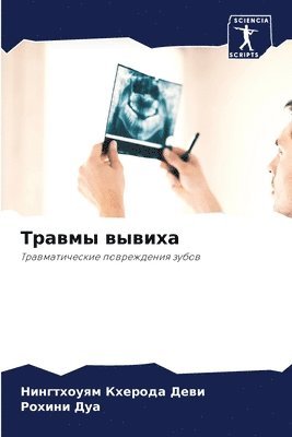 Нингтхоуям Кхер Деви, Рохини Дуа, &#1053;&#1 &#1044;&#1077;&#1074;&#1080;, &#1056;&#1086;&#1 &#1044;&#1091;&#1072;, ¿¿¿¿¿¿¿¿¿¿ ¿¿¿¿ ¿¿¿¿, ¿¿¿¿¿¿ ¿¿¿ - Травмы вывиха, Häftad