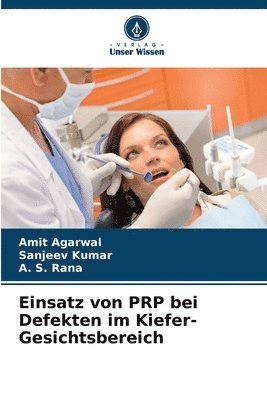 Amit Agarwal, Sanjeev Kumar, A S Rana - Einsatz von PRP bei Defekten im Kiefer-Gesichtsbereich, Häftad
