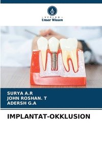 bokomslag Implantat-Okklusion