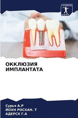 Сурья &#1040.&#1056, ЙОХН &#1056&#1054&#1057&#1061&#1040&#1053. &#1058, АДЕРСХ &#1043.&#1040, &#1057;&#1091;&#1088;&#11 &#1040.&#1056, &#1056&#1054&#1057&#1061&#1040&#1053. &#, ¿¿¿¿¿ ¿.¿, ¿¿¿¿ ¿¿¿¿¿¿. ¿, Sur'q A. R - ОККЛЮЗИЯ ИМПЛАНТАТА, Häftad