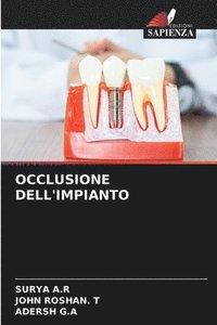 bokomslag Occlusione Dell'impianto