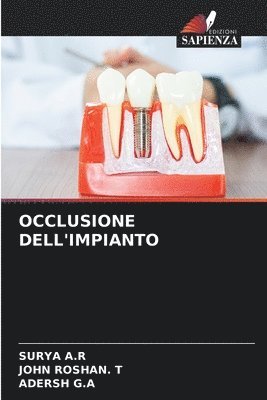 Occlusione Dell'impianto 1