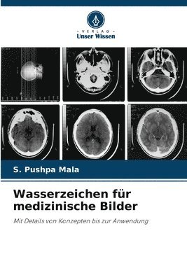 Wasserzeichen fr medizinische Bilder 1