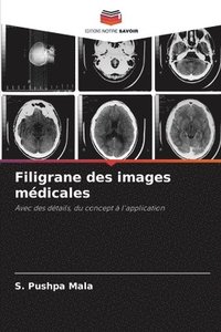 bokomslag Filigrane des images mdicales