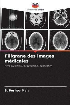 Filigrane des images mdicales 1