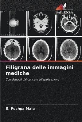 bokomslag Filigrana delle immagini mediche