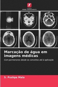 bokomslag Marcao de gua em imagens mdicas