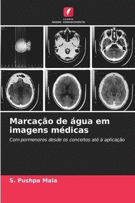 bokomslag Marcao de gua em imagens mdicas