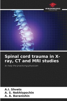 bokomslag Spinal cord trauma in X-ray, CT and MRI studies