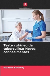 bokomslag Teste cutneo da tuberculina