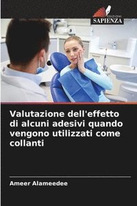 bokomslag Valutazione dell'effetto di alcuni adesivi quando vengono utilizzati come collanti