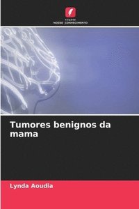 bokomslag Tumores benignos da mama