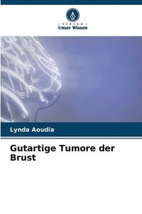 bokomslag Gutartige Tumore der Brust