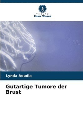 Gutartige Tumore der Brust 1