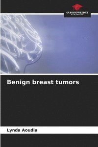 bokomslag Benign breast tumors