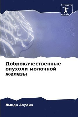 Доброкачественные опухоли молочной желе&