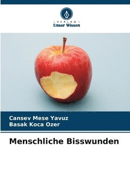 bokomslag Menschliche Bisswunden