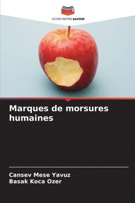 bokomslag Marques de morsures humaines