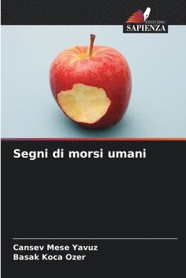 Segni di morsi umani 1