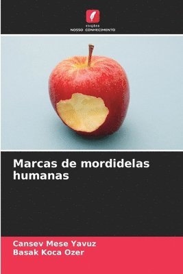 bokomslag Marcas de mordidelas humanas