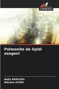 bokomslag Polmonite da lipidi esogeni