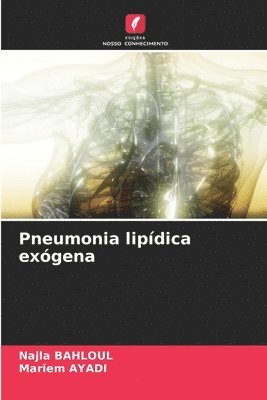 Pneumonia lipídica exógena