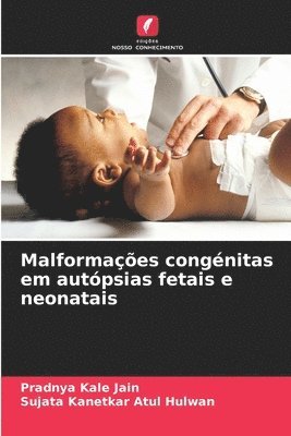 bokomslag Malformaes congnitas em autpsias fetais e neonatais