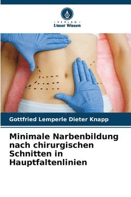 bokomslag Minimale Narbenbildung nach chirurgischen Schnitten in Hauptfaltenlinien