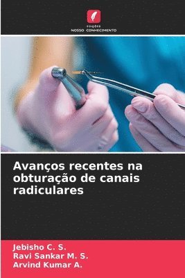 Avanos recentes na obturao de canais radiculares 1